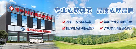 福州白癜风所